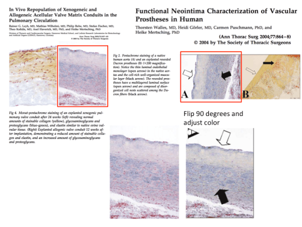 Würzburg misconduct Commission acquits Walles, dismisses biased medical expert, restarts anew as data manipulations flood&nbsp;in
