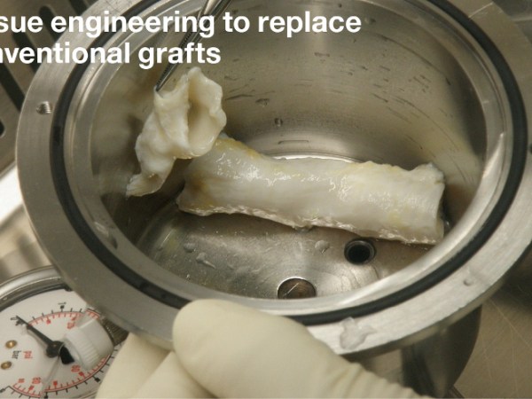 UCL’s decellurised tracheas: strong and&nbsp;stable?