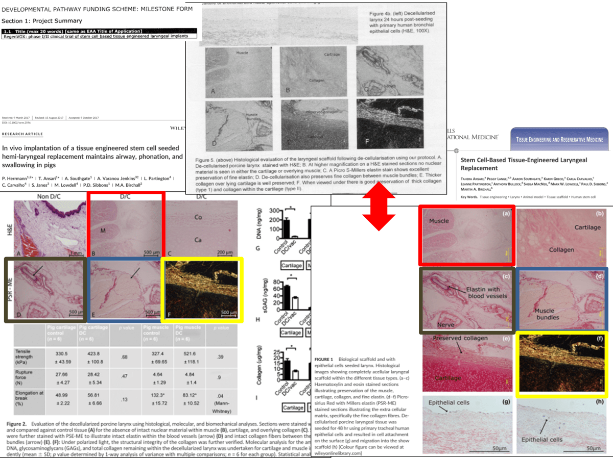 Image reuse, the new low of UCL trachea transplanter Martin&nbsp;Birchall?