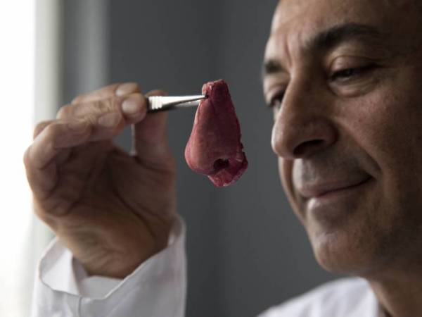 UCL trachea transplant inquiry: scapegoating, obfuscation and a lost&nbsp;nose