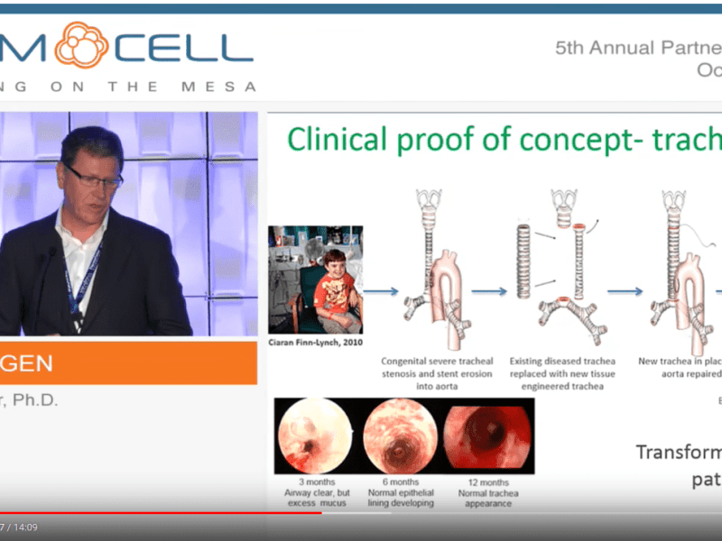 UCL trachea transplants: Videregen sets lawyers on Liverpool academics Murray and&nbsp;Levy