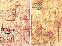 Deliferate misteaks by Tradional Chinese&nbsp;Medicine